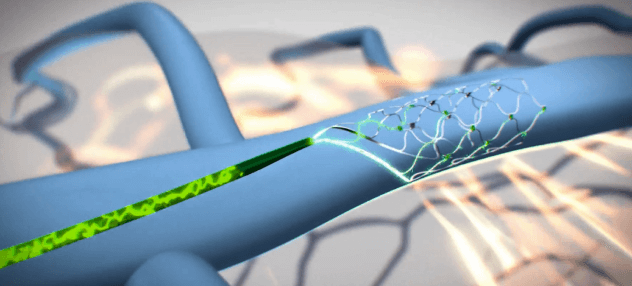 Implantable Brain-Computer Interface Collaborative Community (iBCI-CC) to Drive Innovation in Neurotechnology